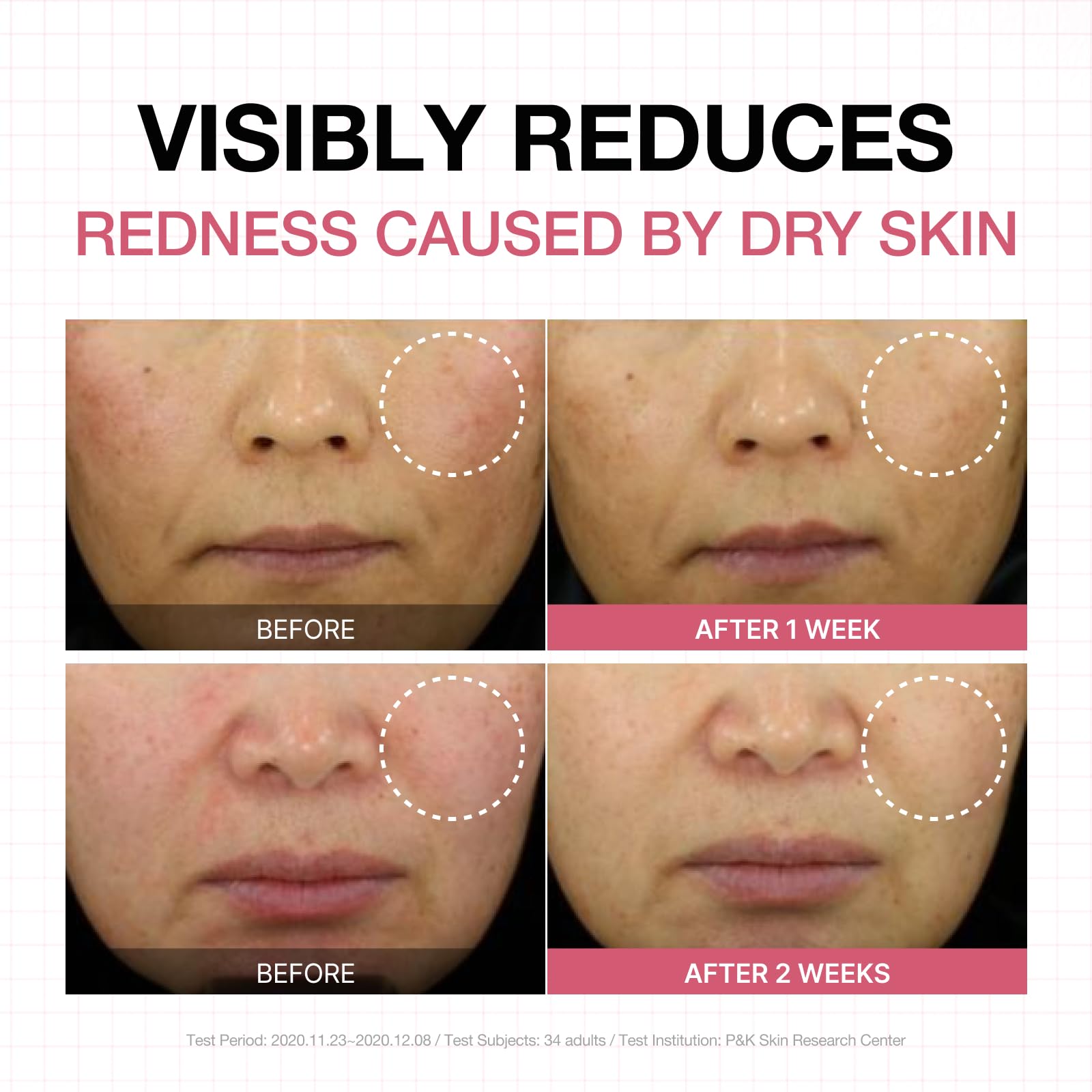 Physiogel Calming Relief on the arm shows gentle, fragrance-free moisturization.
