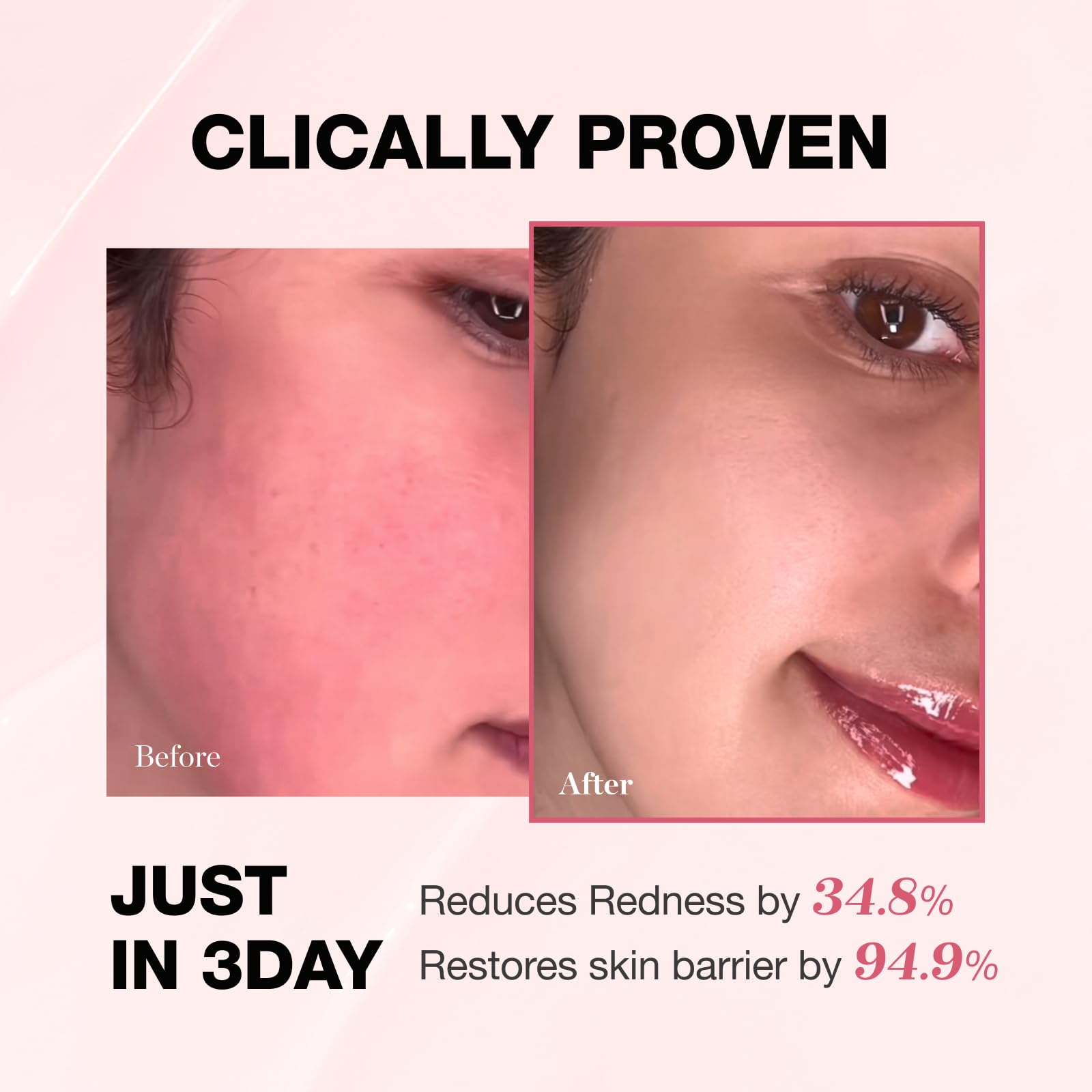 Physiogel redness reducing cream daily routine application, calming dry, itchy skin.