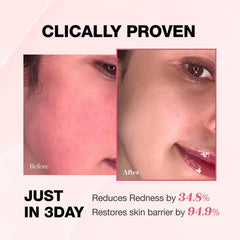 Physiogel redness reducing cream daily routine application, calming dry, itchy skin.