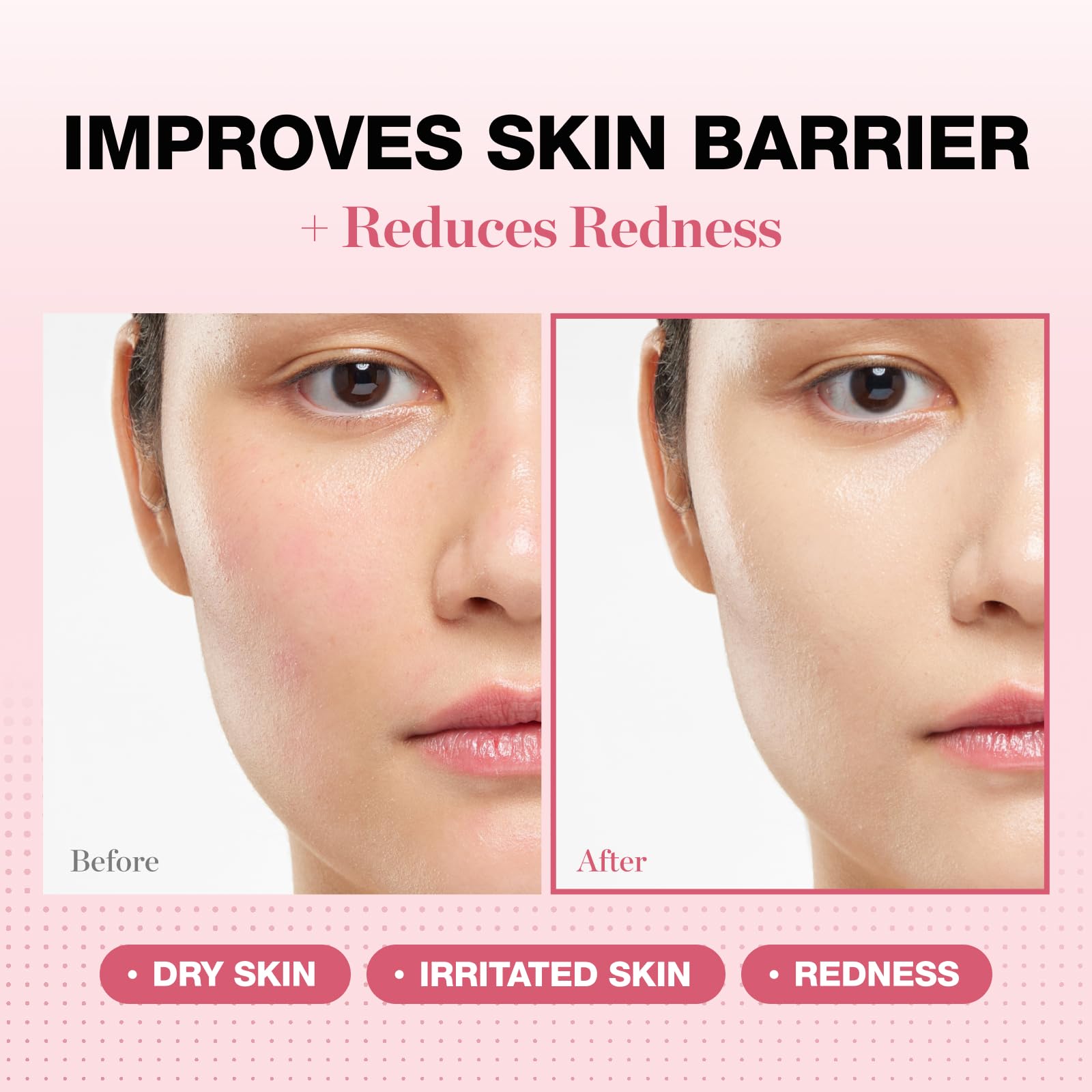 Physiogel redness reducing cream label detail, NEA-accepted care for redness-prone skin.