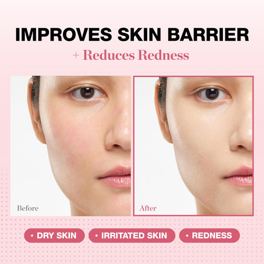 Physiogel redness reducing cream label detail, NEA-accepted care for redness-prone skin.