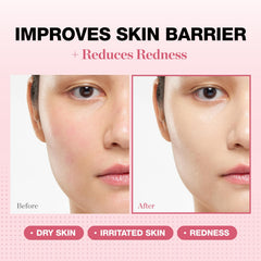 Physiogel redness reducing cream label detail, NEA-accepted care for redness-prone skin.