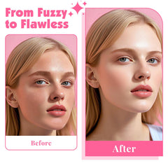 Phyyixs stainless steel micro-blades for safe exfoliation.