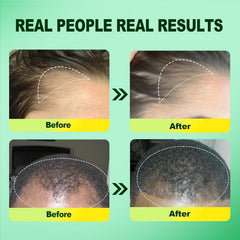 Pipuxi serum dropper applying formula to scalp for renewed hair vitality.