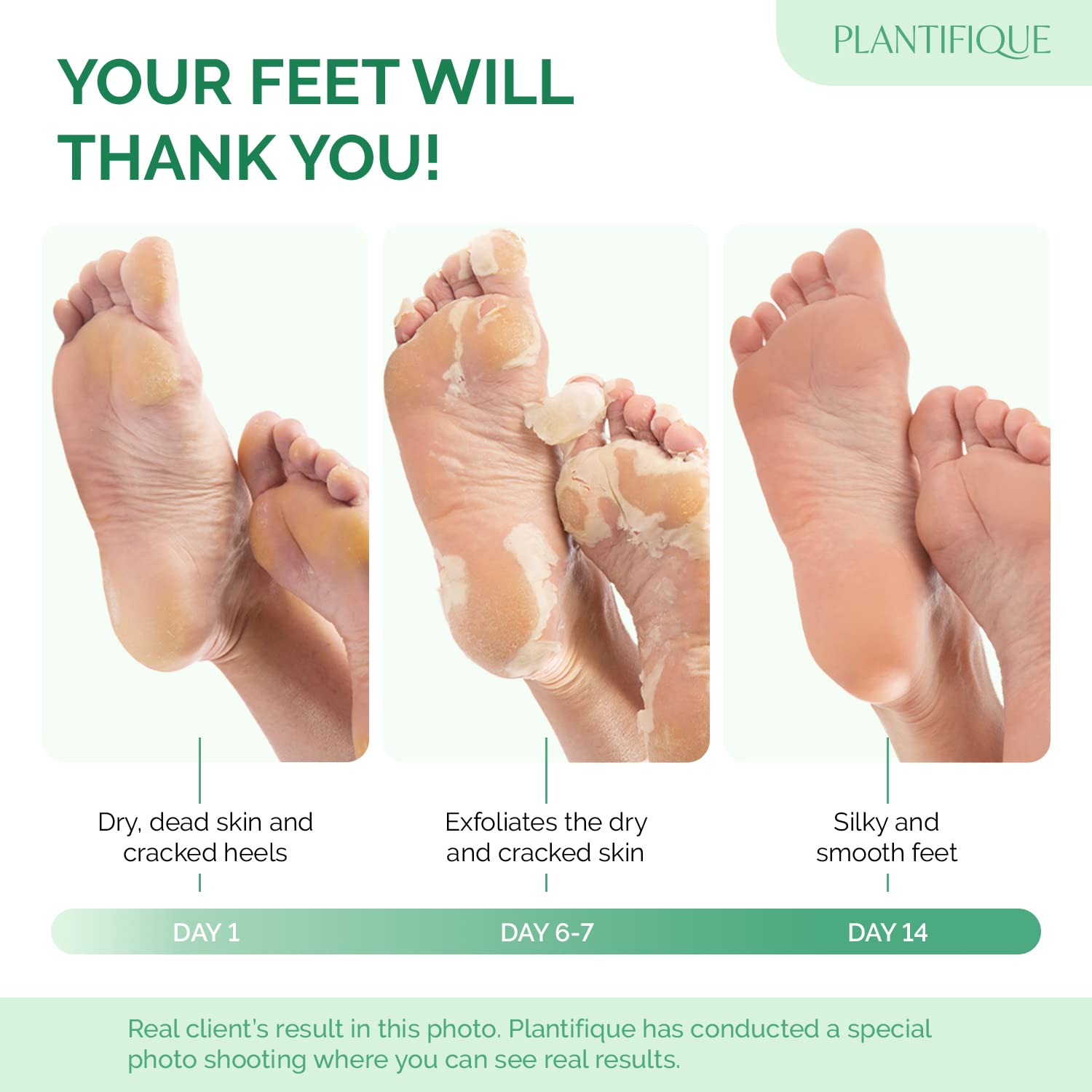 PLANTIFIQUE Foot Peeling Mask 4 Pack packaging highlighting dermatological safety