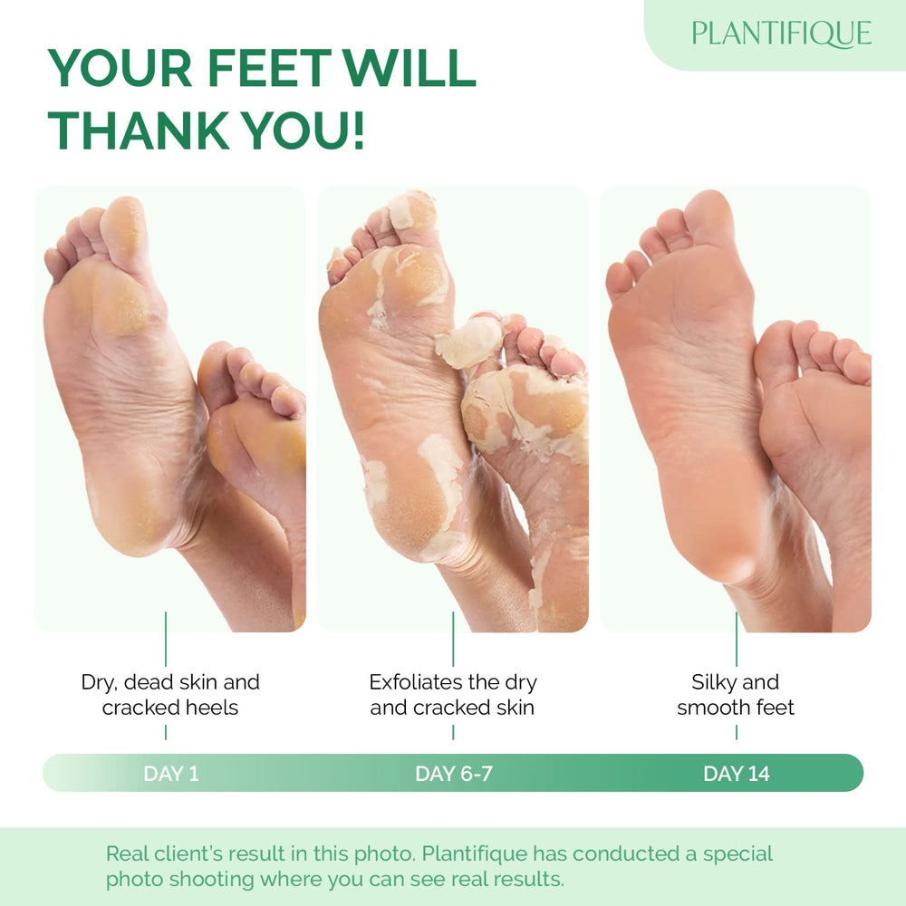 PLANTIFIQUE Foot Peeling Mask 4 Pack packaging highlighting dermatological safety