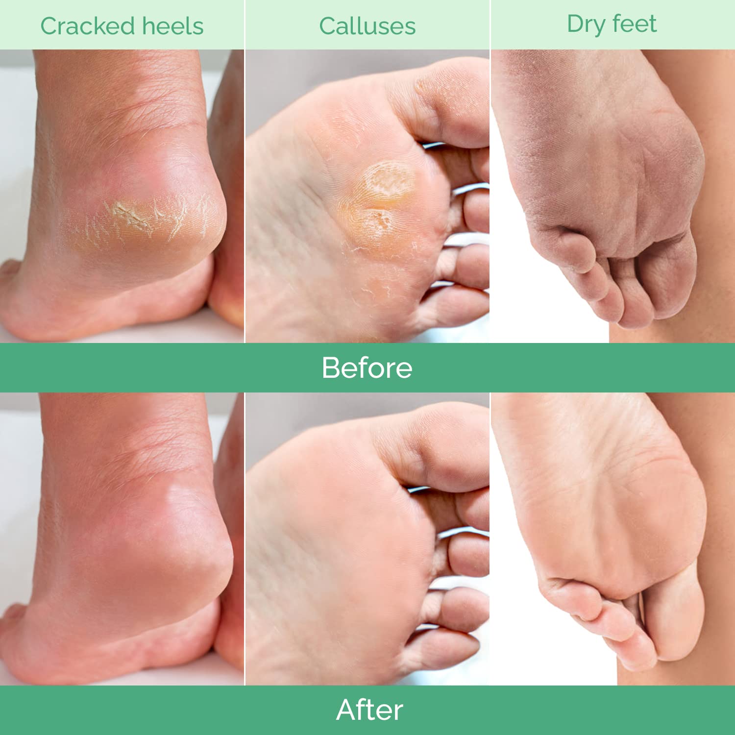 PLANTIFIQUE Foot Peeling Mask soaking scene shows prep step