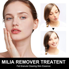 Platicat Milia Remover Serum applied around eye-area for delicate spot care