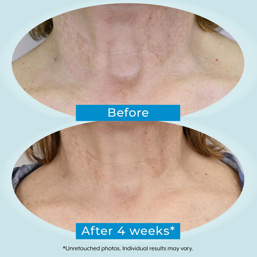 Plexaderm neck cream packaging display emphasizing cruelty-free USA-made formulation