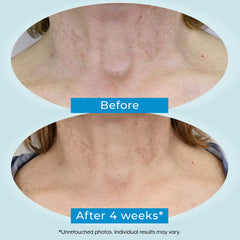 Plexaderm neck cream packaging display emphasizing cruelty-free USA-made formulation