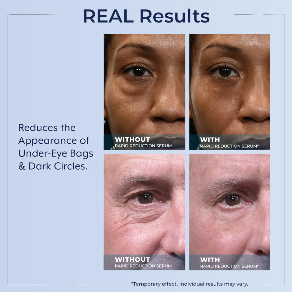 Plexaderm Rapid Reduction Eye Serum long-lasting 10-hour effect around the eye area.