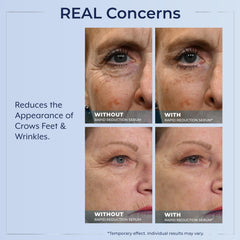 Plexaderm Rapid Reduction Eye Serum before and after highlights instant lifting.