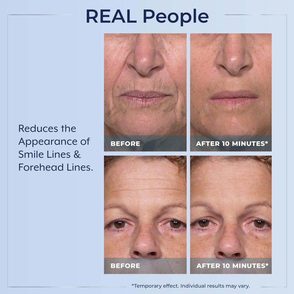Plexaderm Rapid Reduction Eye Serum visible reduction of under-eye puffiness after use.