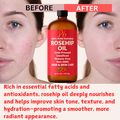 Carrier oil for essential blends with Pomberries Rosehip Oil.