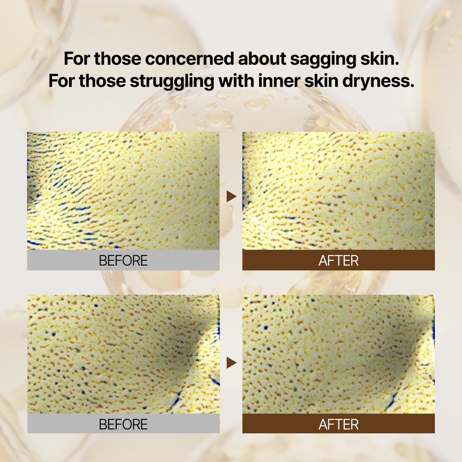 PONGDANG Korean skincare ritual step featuring pore care for a smoother complexion.