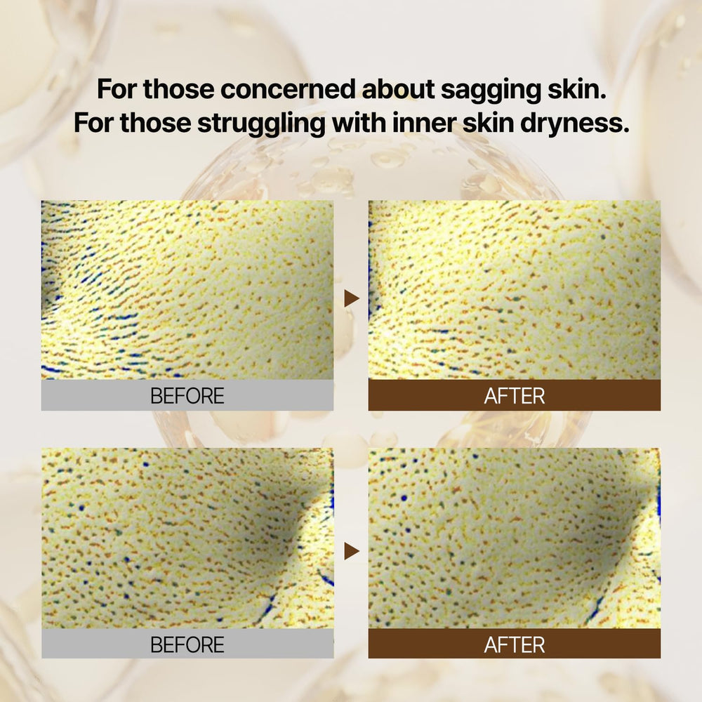 PONGDANG Korean skincare ritual step featuring pore care for a smoother complexion.