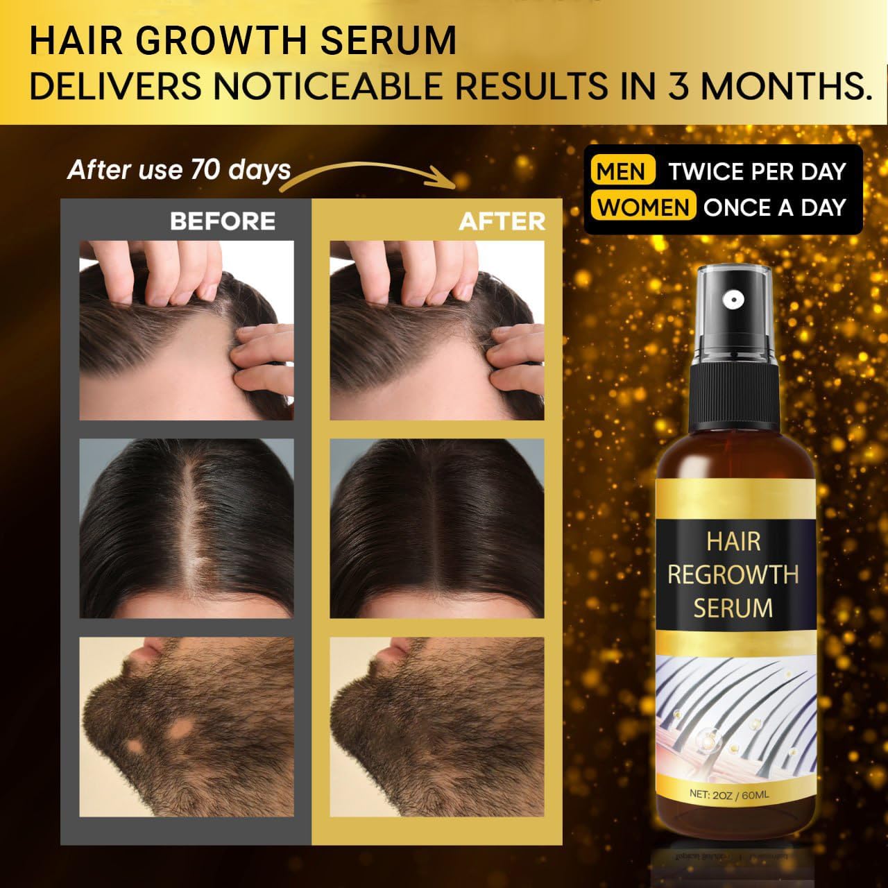 Praiasol Hair Growth Oil Spray in action for scalp application.