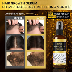 Praiasol Hair Growth Oil Spray in action for scalp application.
