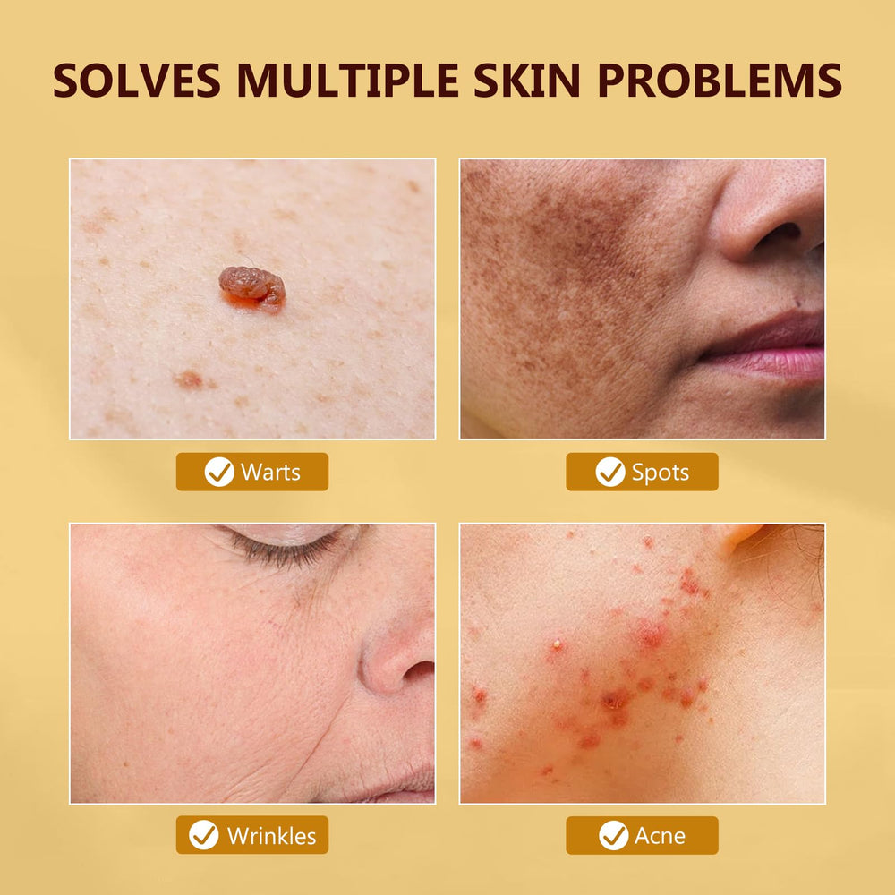Prettypum Bee Venom Cream on face, neck, and body for multi-use care
