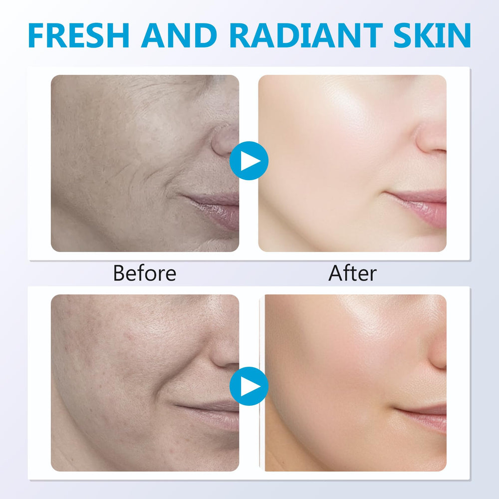 Ingredients circle on Prettypum Salmon DNA Ampoule indicating a gentle formula