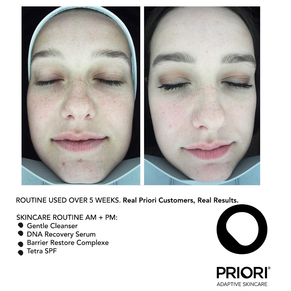 DNA repair enzymes and antioxidants support skin vitality