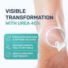 PROJECT 701 Urea Cream application pump demonstrates easy, precise use