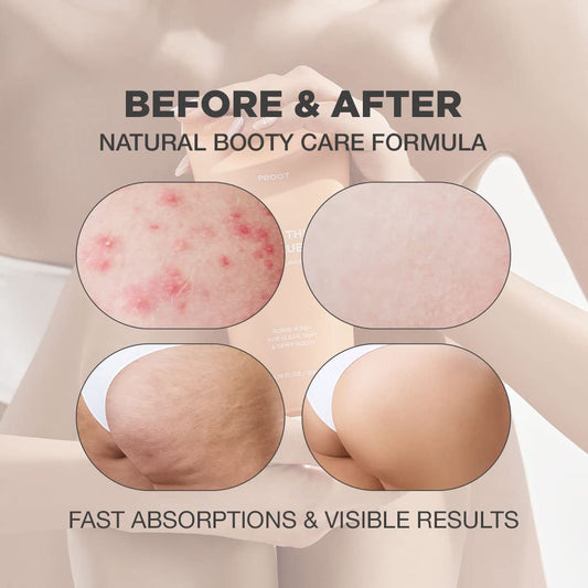 PROOT Butt Scrub Wash texture closeup—micro-exfoliants for even skin tone.
