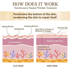 Prypug eye-area patches smoothing fine lines around the eyes