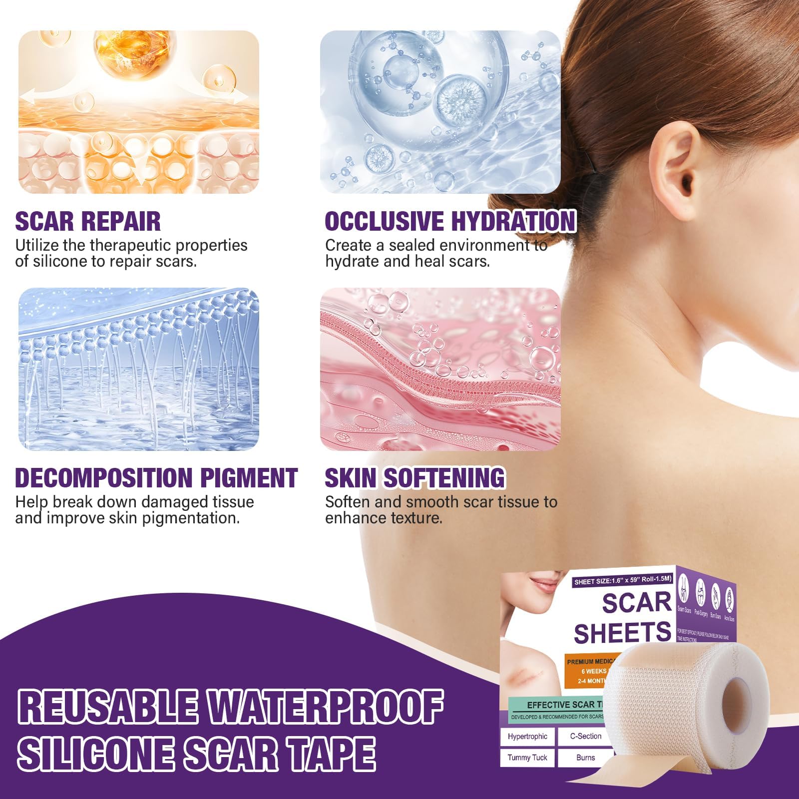 Psecici silicone scar sheets reusable and simple to clean
