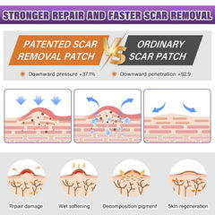 Psecici silicone scar sheets soft breathable texture for daily comfort