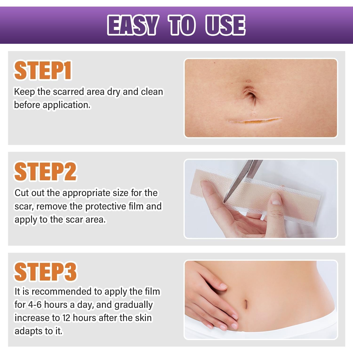 Psecici silicone scar sheets suitable for surgical scars and C sections