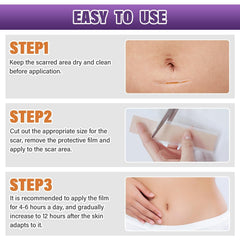 Psecici silicone scar sheets suitable for surgical scars and C sections