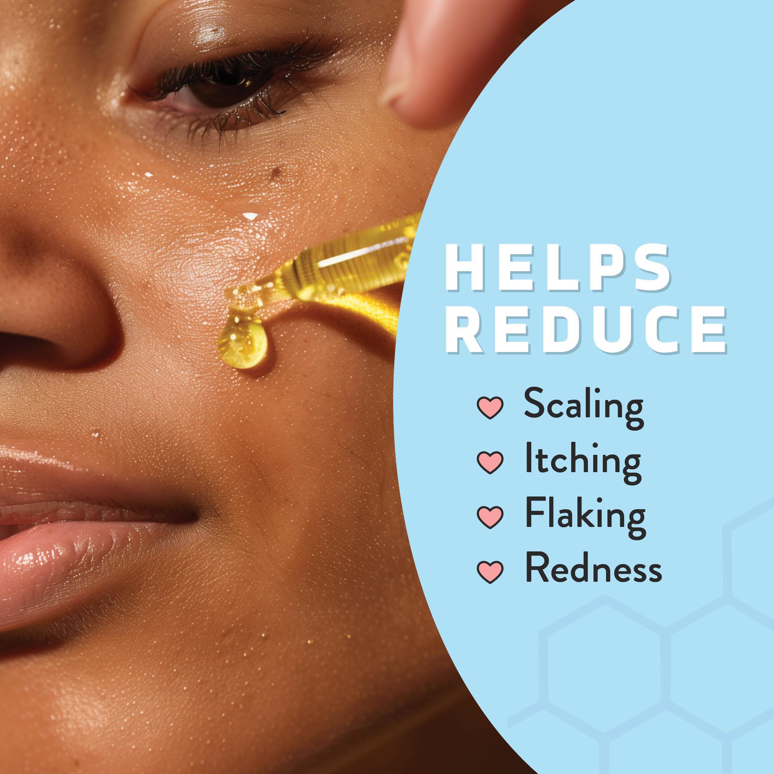 Psoriasis Honey leaves skin glowing and healthy after application