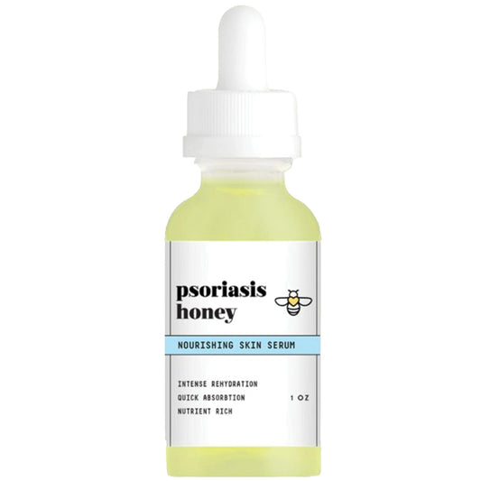 Psoriasis Honey Nourishing Scalp Serum bottle provides non-greasy hydration for sensitive skin