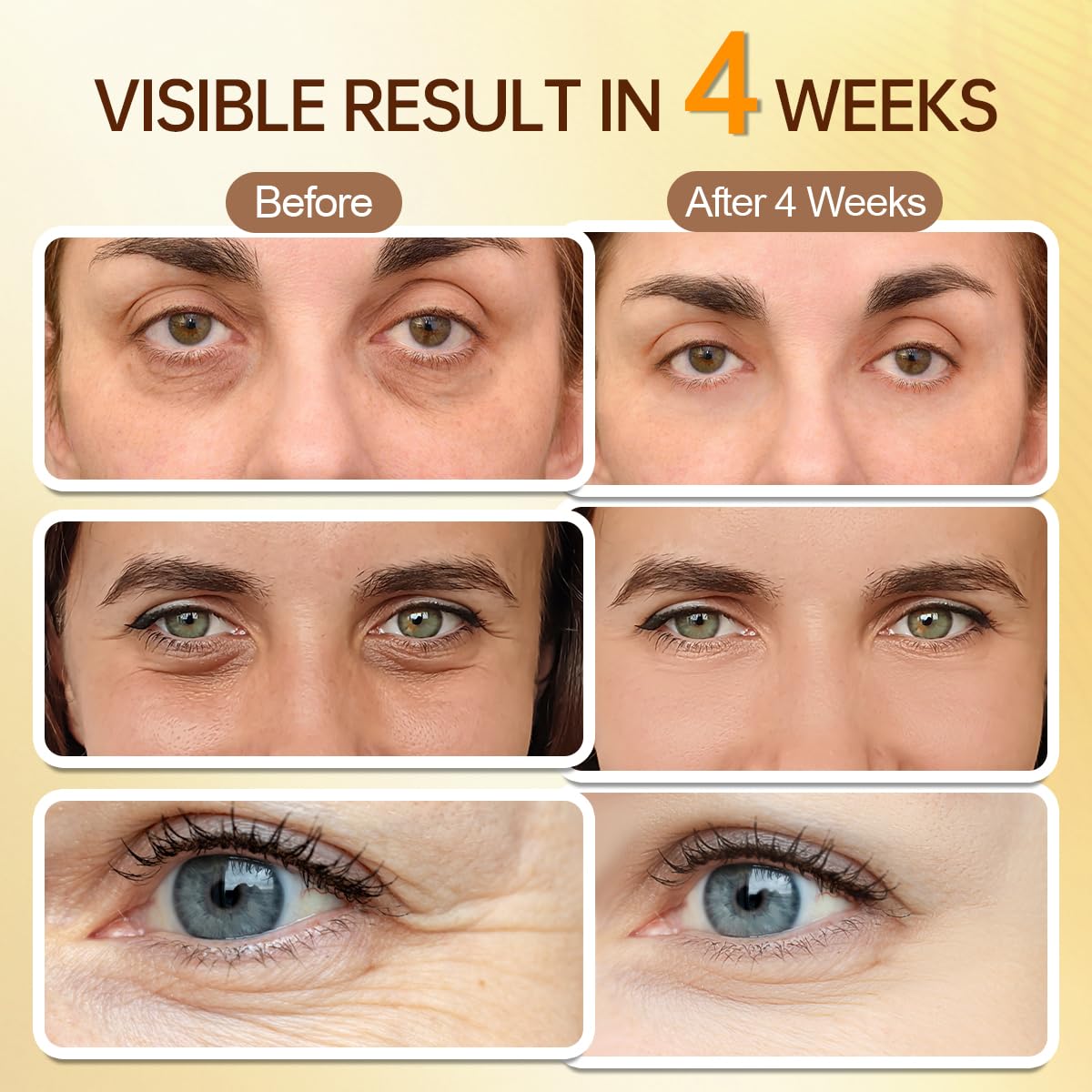 PUILOG retinaldehyde complex smooths the look of fine lines around the eyes.