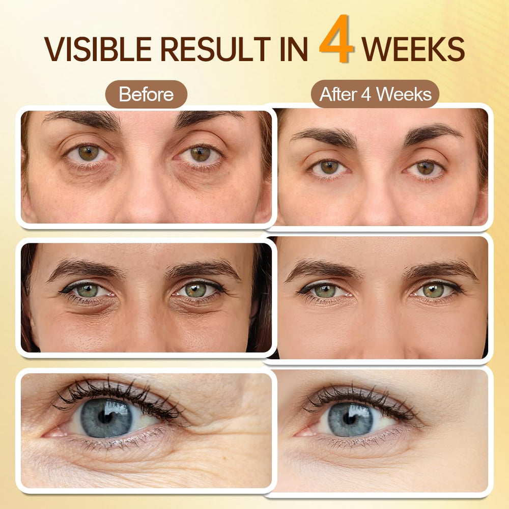 PUILOG retinaldehyde complex smooths the look of fine lines around the eyes.