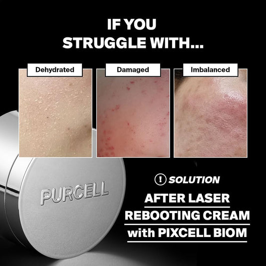 Purcell Pixcell Biom probiotic complex ingredients showing skin resilience benefits.