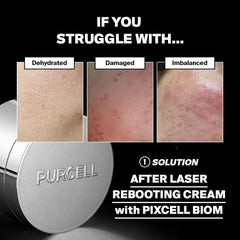 Purcell Pixcell Biom probiotic complex ingredients showing skin resilience benefits.