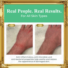 Pure Truth organic honey and aloe vera blend improves moisture for skin