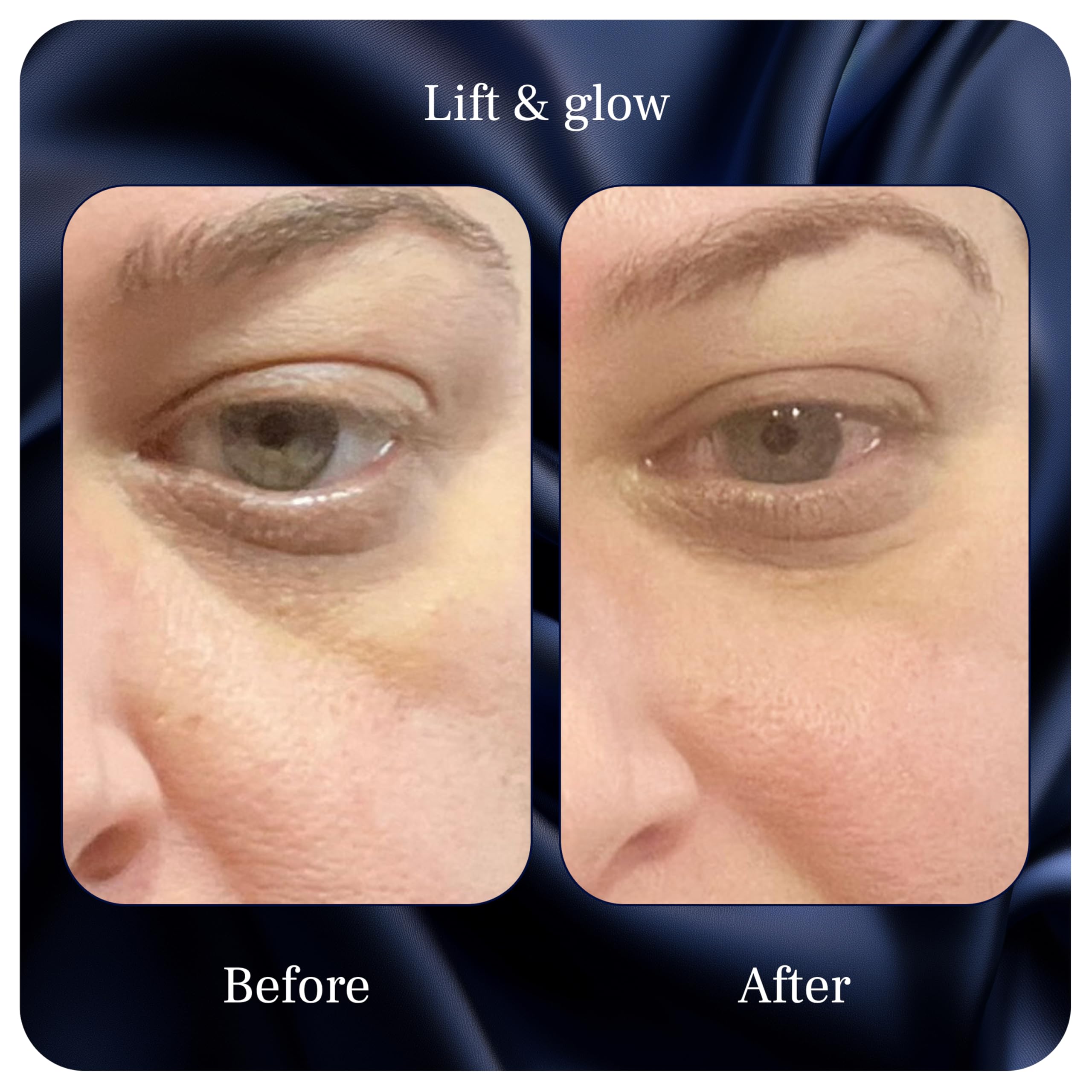 Evening routine scene with Pureance eye cream in calm ambiance