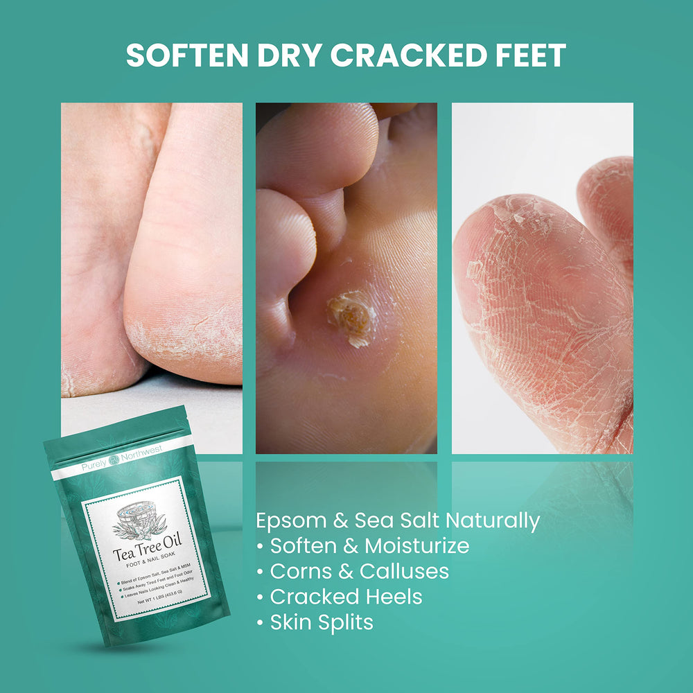 Purely Northwest clean label packaging for at-home foot care