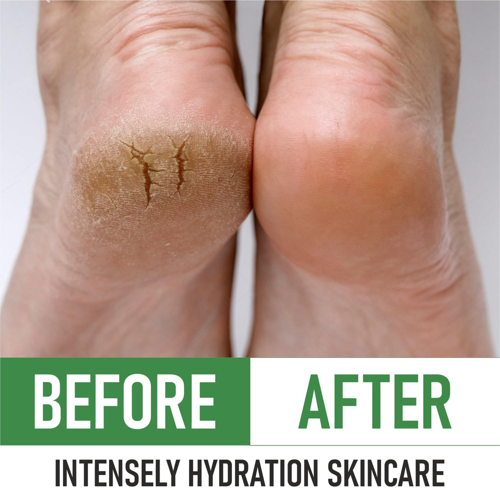 Tea Tree oil and botanicals in PurOrganica Urea 40% Foot Cream for refreshing care.