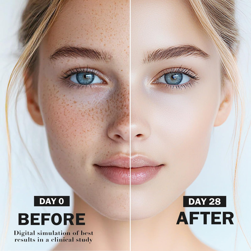 QGGQ Dark Spot Serum addressing melasma concerns