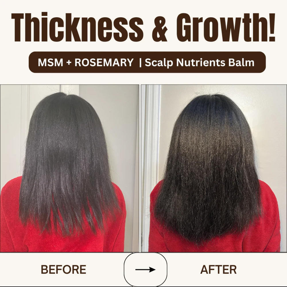 Qhemet Biologics MSM + Rosemary Scalp Balm massaged into the scalp for follicle care.