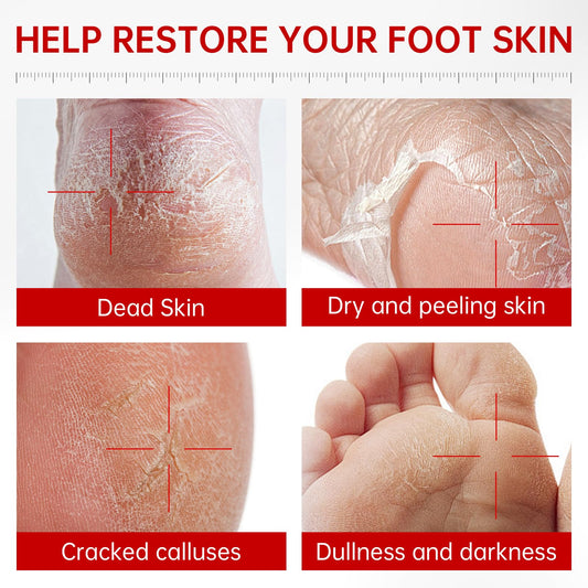 QQE Foot Peel Mask application scene highlighting a simple pampering ritual.