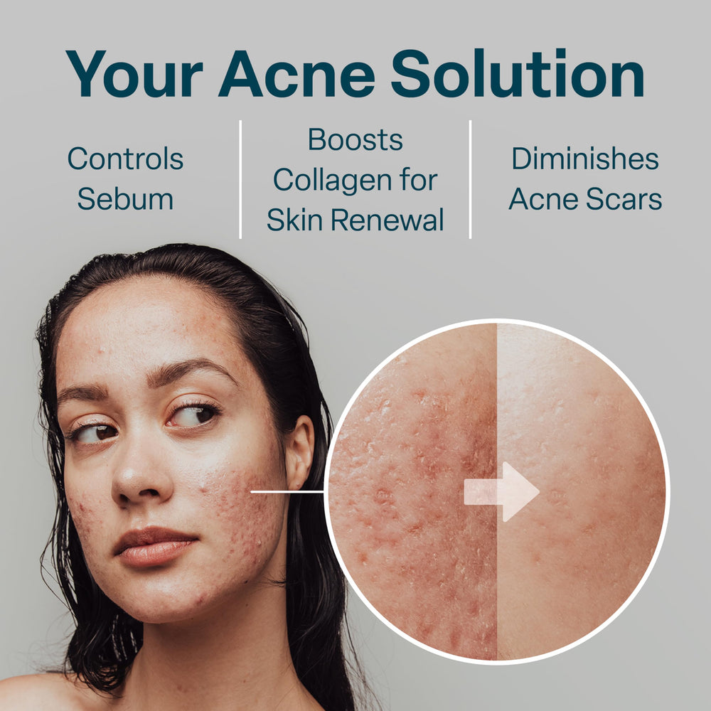 QRxLabs pads in use on the face for simple routine.