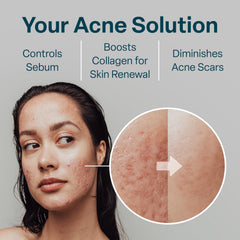 QRxLabs pads in use on the face for simple routine.