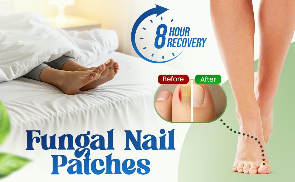 QUDSIYA waterproof toenail patch on toe, reliable overnight wear.