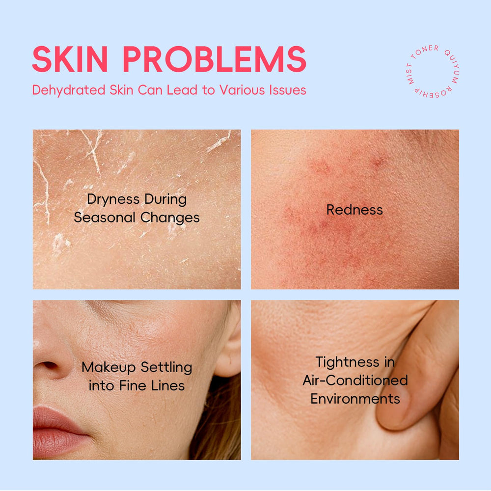 QUIYUM Rosehip Cream Texture Closeup shows thick, nourishing formula without heaviness.