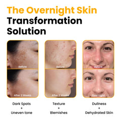 QUIA Beauty Turmeric + Kojic Overnight Wrap texture ready for bedtime application